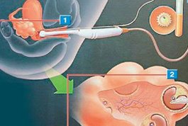 佛山能做什么三代试管婴儿医院排名分享？